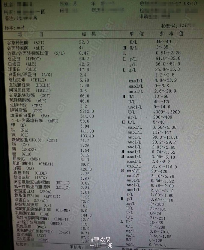 多并发症的2型糖尿病病例1例