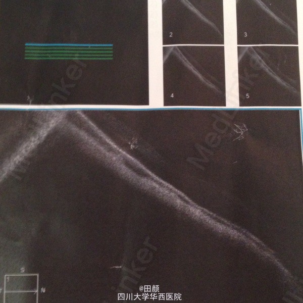 OD体育官方网站(OD SPORTS)全球赔率最高在线投注平台交际翻译视角下的广告翻译探究