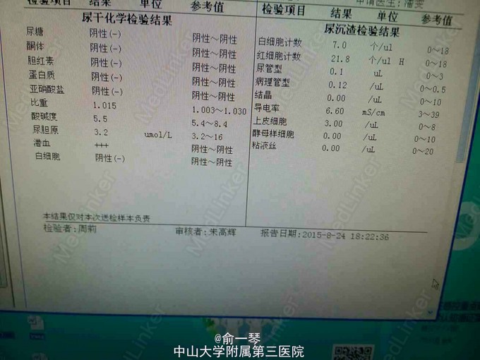 别嘌醇过敏全身剥脱性皮炎mods