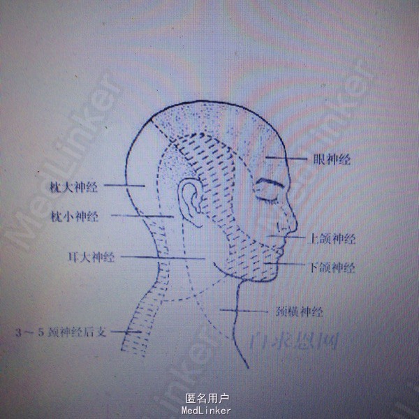 随访 讨论 枕大神经痛的治疗类似于三叉神经痛,临床表现为枕大神经