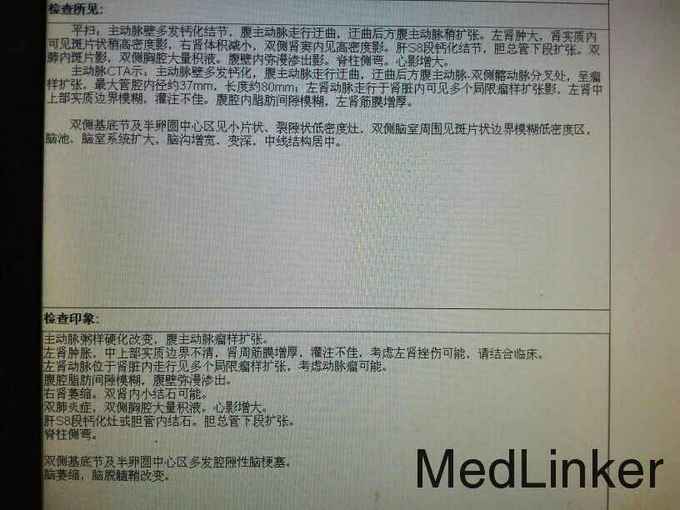 腹主动脉瘤合并肾动脉瘤破裂出血一例