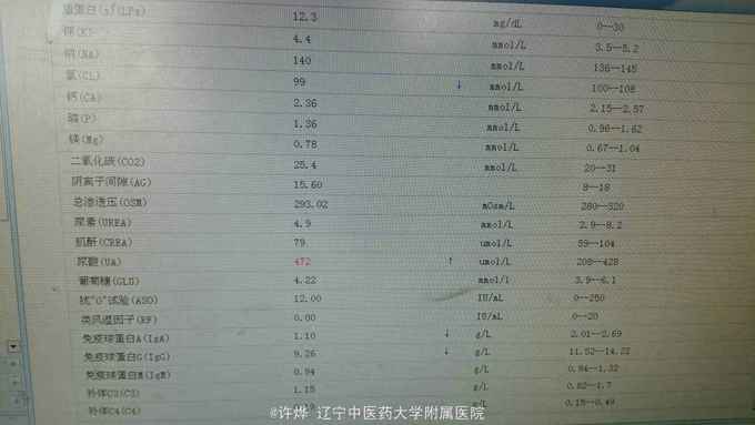胡桃夹综合征