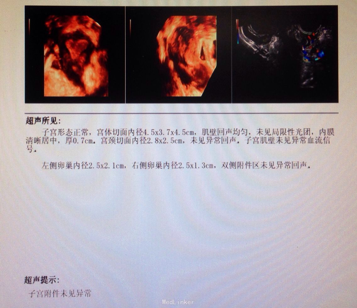 前列腺肿大病变组织 100x高清摄影大图-千库网