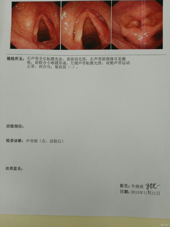 困难,无吞咽困难,今年10月患者就就诊于当地医院,行声带肿物切除术,术