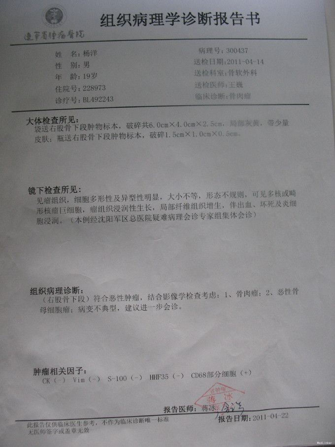 ct股骨模板报告