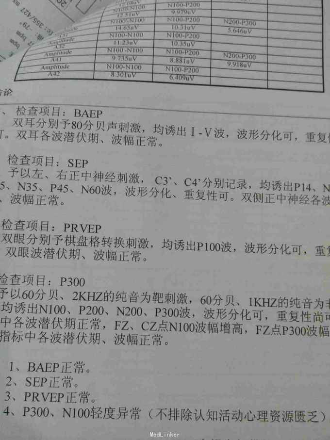 早期以强迫症为表现的双相情感障碍病例患者,蒋某,男性,41岁.