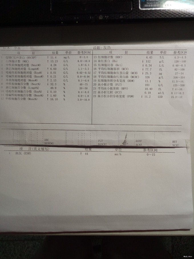 eb病毒传染性单核细胞增多症1例