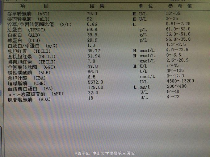 急性黄疸型戊型病毒性肝炎